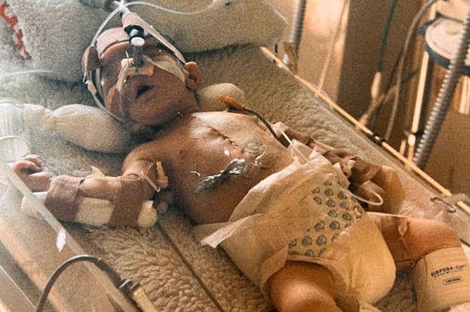 Dave Masson underwent groundbreaking open-heart surgery when he was just two days old